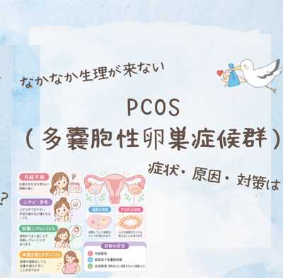 多嚢胞性卵巣症候群（PCOS）の症状・原因・検査・治療をまとめた総合イラスト